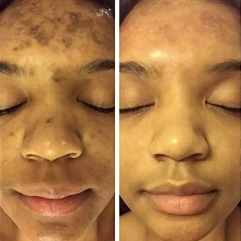 BrightGlow Turmeric Radiance Serum - Unleash Your Skin's Natural Glow