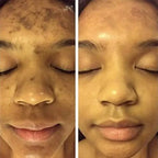 BrightGlow Turmeric Radiance Serum - Unleash Your Skin's Natural Glow