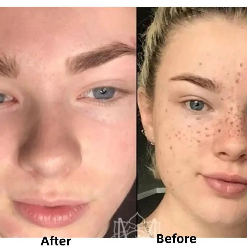 BrightGlow Turmeric Radiance Serum - Unleash Your Skin's Natural Glow