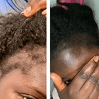 Mega Ayurvedic Hair Oil